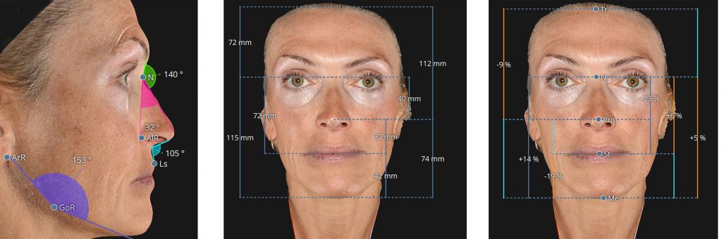 Facial Beauty and the “New” Golden Ratio (or is it just 1.618?)